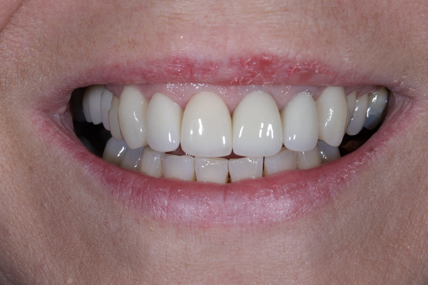 The same smile after treatment